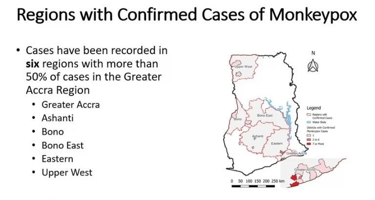 Greater Accra has more than half of all monkeypox cases in Ghana